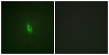 IP3R-I (phospho-Ser1598) antibody