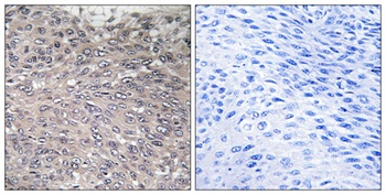 IP3R-I (phospho Ser1598) rabbit pAb