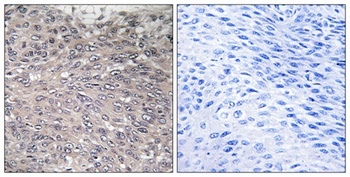 IP3R-I (phospho-Ser1598) antibody