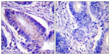 eIF4B (phospho-Ser422) antibody