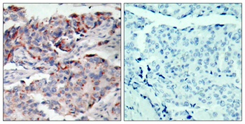 JAK2 (phospho-Tyr221) antibody