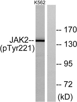 JAK2 (phospho-Tyr221) antibody