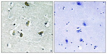 JAK2 (phospho Tyr931) rabbit pAb
