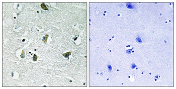 JAK2 (phospho-Tyr931) antibody