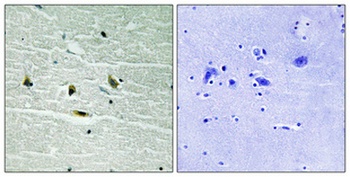 JAK2 (phospho Tyr119) rabbit pAb