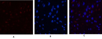 JAK3 antibody