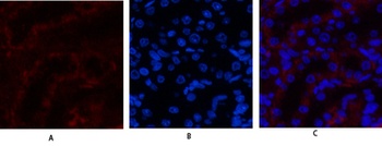 JAK3 antibody