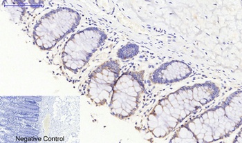 JAK3 antibody