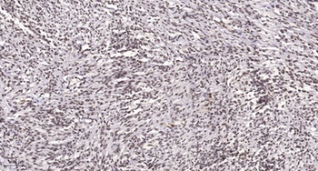 AP-1 (phospho Tyr170) rabbit pAb