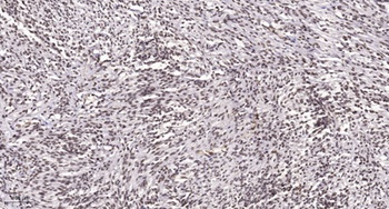 AP-1 (phospho-Tyr170) antibody