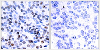 Jun B antibody