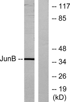 Jun B antibody