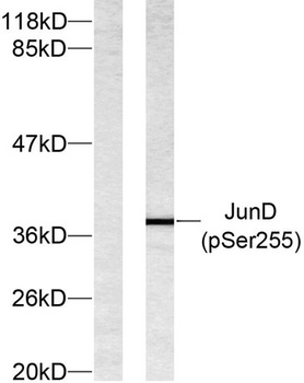 Jun D (phospho Ser255) rabbit pAb