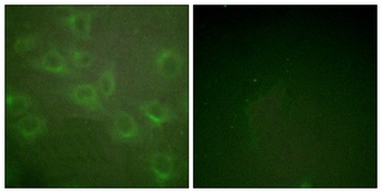 Kv1.3 (phospho-Tyr187) antibody