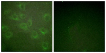 Kv1.3 (phospho Tyr187) rabbit pAb