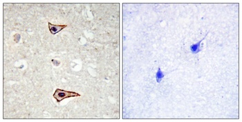 Kv1.3 (phospho Tyr187) rabbit pAb
