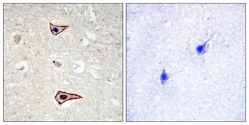 Kv1.3 (phospho-Tyr187) antibody