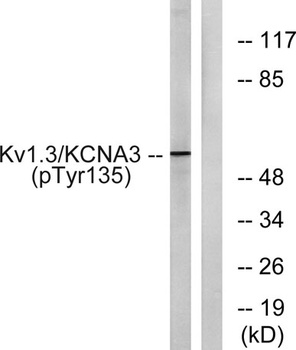 Kv1.3 (phospho-Tyr187) antibody