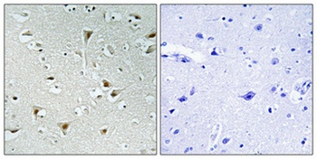 FAM111B rabbit pAb