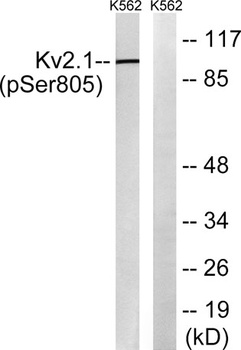 KV2.1 (phospho Ser805) rabbit pAb