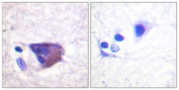Kv2.1 (phospho Ser567) rabbit pAb
