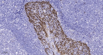 Kv4.2 (phospho Ser616) rabbit pAb