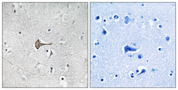 Kv4.2 rabbit pAb Antibody