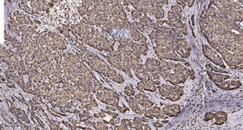 KCNF1 antibody