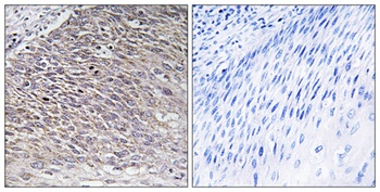 MAST4 antibody