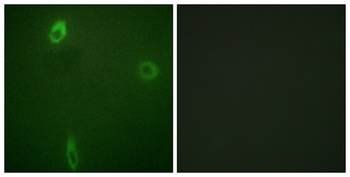 ROM-K (phospho Ser44) rabbit pAb