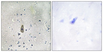 ROM-K (phospho Ser44) rabbit pAb