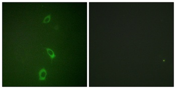 ROM-K rabbit pAb Antibody