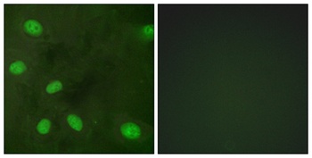 KIR3.1 (phospho-Ser185) antibody