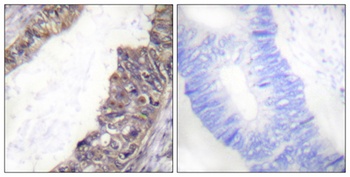 KIR3.1 (phospho Ser185) rabbit pAb