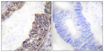 KIR3.1 (phospho-Ser185) antibody