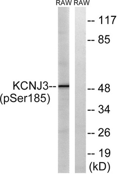 KIR3.1 (phospho-Ser185) antibody