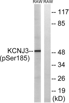 KIR3.1 (phospho Ser185) rabbit pAb