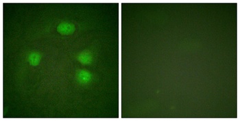 KIR3.1 antibody