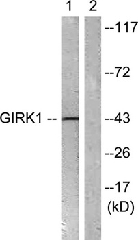 KIR3.1 antibody