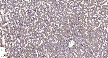 KIR3.1 antibody