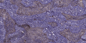 KIR3.4 antibody