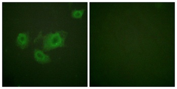 KIR6.2 (phospho Thr224) rabbit pAb