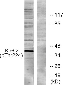 KIR6.2 (phospho Thr224) rabbit pAb