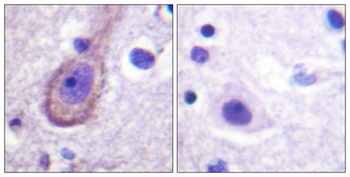 KCNQ2/3/4/5 (phospho Thr217/246/223/251) rabbit pAb