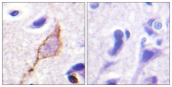 KCNQ2/3/4/5 rabbit pAb Antibody