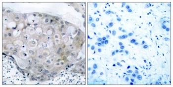 Flk-1/VEGFR2 (phospho Tyr951) rabbit pAb