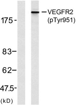 Flk-1/VEGFR2 (phospho Tyr951) rabbit pAb