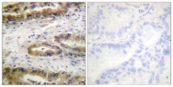 Flk-1/Flt-4 (phospho Tyr1054/Y1063) rabbit pAb