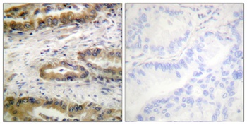 Flk-1/Flt-4 (phospho-Tyr1054/Y1063) antibody