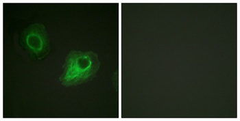 Flk-1/Flt-4 rabbit pAb Antibody